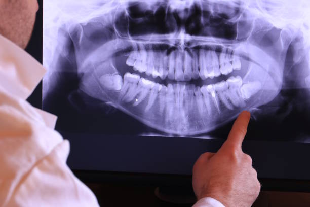 Best Cosmetic Emergency Dentistry in Mandeville, LA
